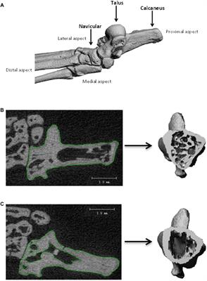 Eight Days of Earth Reambulation Worsen Bone Loss Induced by 1-Month Spaceflight in the Major Weight-Bearing Ankle Bones of Mature Mice